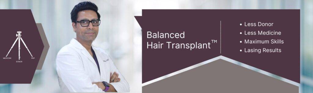 balanced hair transplant