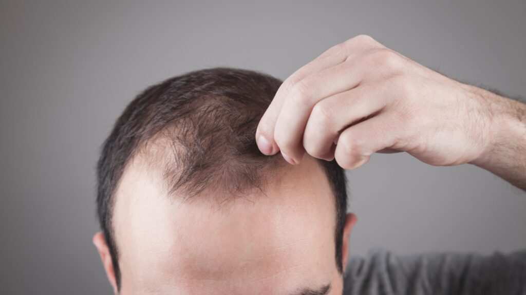 Understanding Hair Loss's Effects