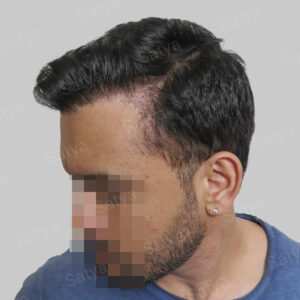 corrective hair repair result