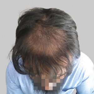 wrong hair repair result