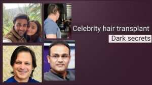 Unveiling the Dark Secrets of a Celebrity Hair Transplant Clinic