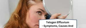 A GUIDE TO THE CAUSES, SYMPTOMS, AND TREATMENTS OF TELOGEN EFFLUVIUM HAIR LOSS