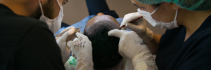 Ways to Use High Density Hair Transplant To Get The Ideal Density?