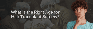 What’s the best age for hair transplant Surgery?