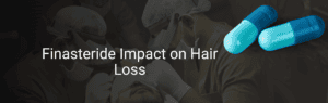 A Comprehensive Guide to Finasteride Usage in Hair Loss