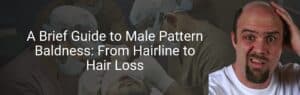 A Brief Guide to Male Pattern Baldness: From Hairline to Hair Loss